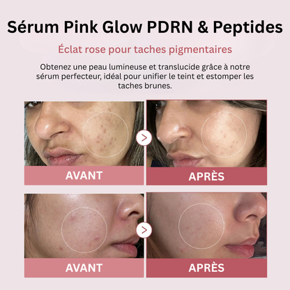 Sérum Pink Glow PDRN