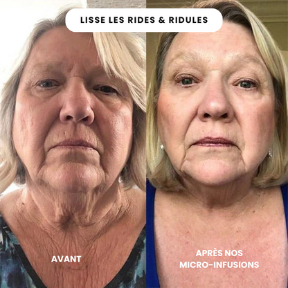 Micro Infusion Anti Âge
