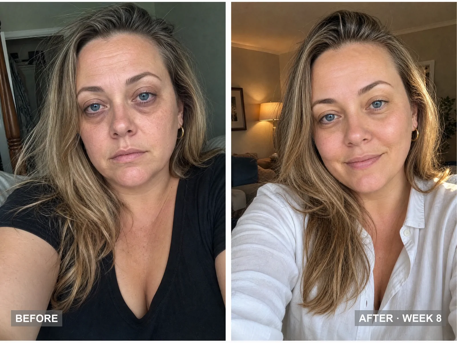 before and after