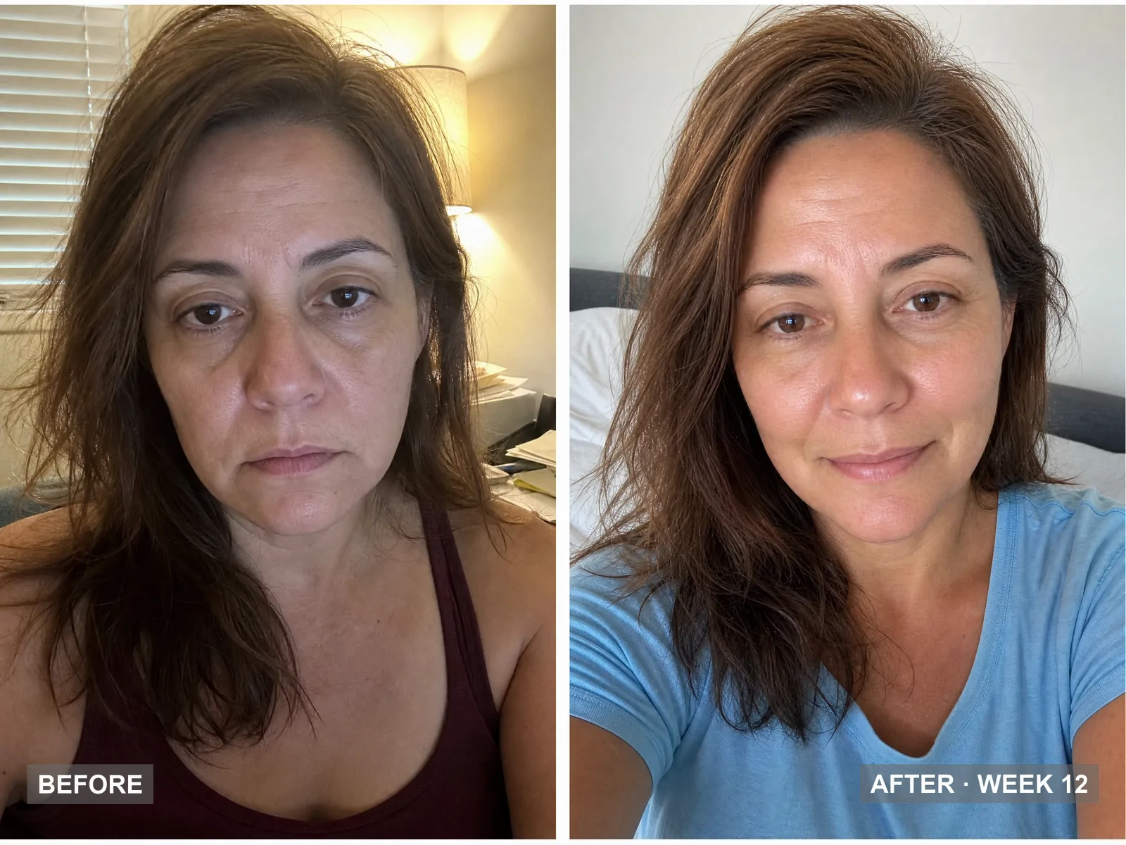 before and after